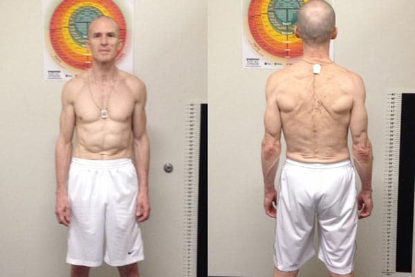 stephen-after-frontandback-