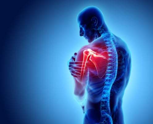 rehab for common shoulder problems
