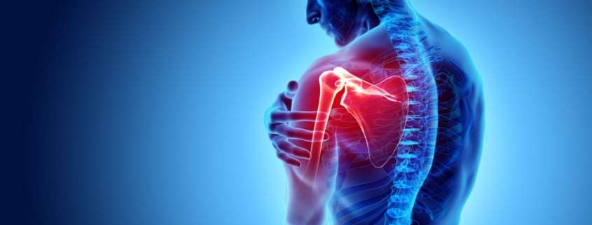 rehab for common shoulder problems
